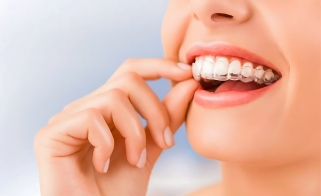 Top Benefits of Invisalign Clear Braces